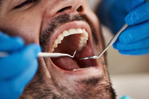 Best Emergency Cosmetic Dentistry in River Bend, NC